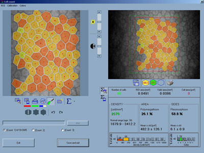 CS4_cellanalysis_400x300.jpg CS4_cellanalysis_400x300.jpg